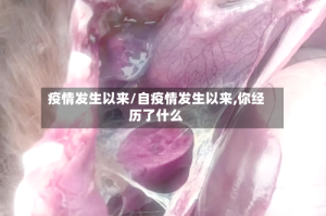 疫情发生以来/自疫情发生以来,你经历了什么