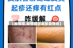 【疫情症,疫情症状皮肤会痒吗】
