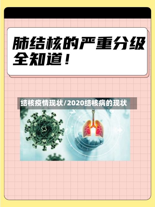 结核疫情现状/2020结核病的现状-第1张图片