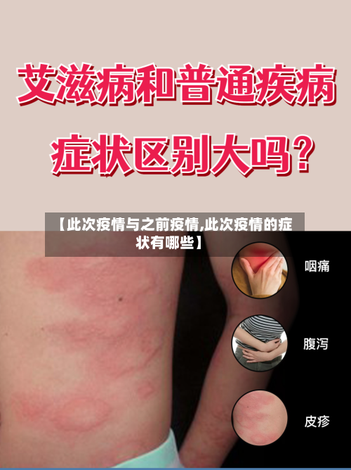 【此次疫情与之前疫情,此次疫情的症状有哪些】-第1张图片