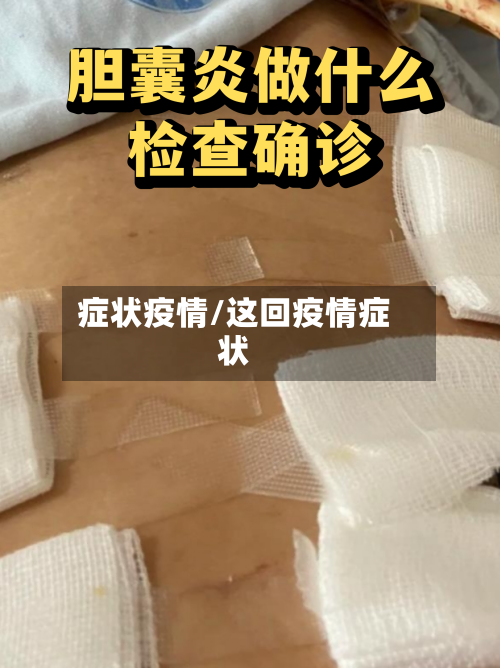 症状疫情/这回疫情症状-第2张图片